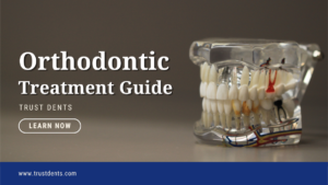 Orthodontic Treatment Guide | Trust Dents