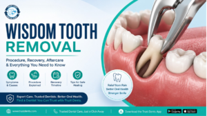Wisdom Tooth Removal: Procedure, Recovery & Aftercare